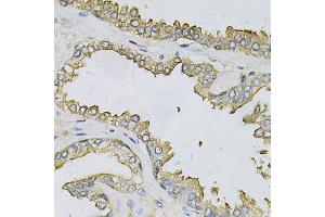 Immunohistochemistry of paraffin-embedded human prostate using APRT Antibody (ABIN6291536) at dilution of 1:100 (40x lens). (APRT Antikörper)