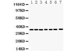 Anti- Annexin A3 Picoband antibody, Western blotting All lanes: Anti Annexin A3  at 0. (Annexin A3 Antikörper  (Middle Region))