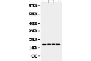 Anti-survivin antibody, Western blotting Lane 1: HELA Cell Lysate Lane 2: JURKAT Cell Lysate Lane 3: CEM Cell Lysate Lane 4: COLO320 Cell Lysate