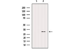 Western blot analysis of extracts from Mouse muscle, using E2F6 Antibody. (E2F6 Antikörper  (Internal Region))