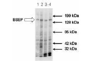 Image no. 1 for anti-ATP-Binding Cassette, Sub-Family B (MDR/TAP), Member 11 (ABCB11) antibody (ABIN187437) (ABCB11 Antikörper)
