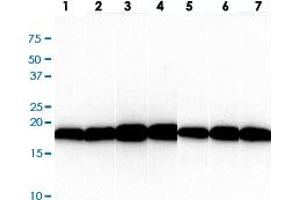 Western blot analysis of (1) HepG2, (2) HeLa, (3) Raji, (4) Jurkat, (5) A549, (6) MCF7, (7) PC3 cell lysate. (VHL Antikörper  (AA 1-154))