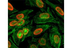 ICC/IF test of HeLa cells treated with sodium butyrate using recombinant H3K9me2 antibody (red). (Rekombinanter Histone 3 Antikörper  (H3K9me2))