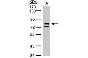 WB Image Sample(30 ug whole cell lysate) A:HeLa S3, 7. (L3MBTL1 Antikörper  (Center))