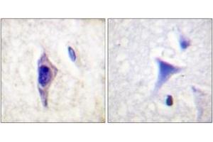 Immunohistochemistry analysis of paraffin-embedded human brain, using PI3-kinase p85-alpha (Phospho-Tyr607) Antibody.