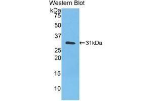 Detection of Recombinant CA3, Human using Monoclonal Antibody to Carbonic Anhydrase III, Muscle Specific (CA3) (CA3 Antikörper  (AA 2-260))