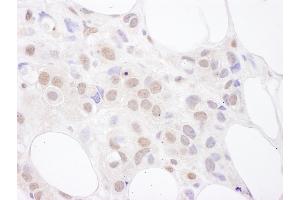 Immunohistochemistry (IHC) image for anti-U2 Small Nuclear RNA Auxiliary Factor 2 (U2AF59) (AA 380-430) antibody (ABIN7454939)