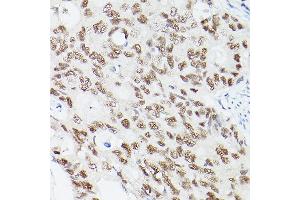 Immunohistochemistry (IHC) image for anti-E1A Binding Protein P300 (EP300) (AA 1-270) antibody (ABIN6140193)
