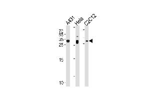 p27Kip1 Antibody (N-term S12) (ABIN1881620 and ABIN2838923) western blot analysis in A431,Hela,mouse C2C12 cell line lysates (35 μg/lane). (CDKN1B Antikörper  (N-Term))