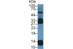 Western Blot; Sample: Human Lung lysate; Primary Ab: 1µg/ml Rabbit Anti-Human NME6 Antibody Second Ab: 0. (NME6 Antikörper  (AA 3-182))