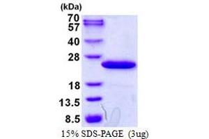 Image no. 1 for TP53RK Binding Protein (TPRKB) (AA 1-1756) protein (His tag) (ABIN1098307)