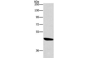 Western Blot analysis of A172 cell using BRS3 Polyclonal Antibody at dilution of 1:500 (BRS3 Antikörper)