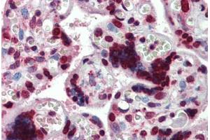 Human Placenta: Formalin-Fixed, Paraffin-Embedded (FFPE) (HMGA1 Antikörper  (AA 9-21))