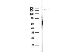 anti-GLI Family Zinc Finger 3 (GLI3) (Internal Region) antibody