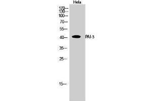 Western Blotting (WB) image for anti-serpin Peptidase Inhibitor, Clade A (Alpha-1 Antiproteinase, Antitrypsin), Member 5 (SERPINA5) (Internal Region) antibody (ABIN3186314)