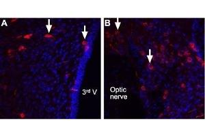 Expression of Angiotensin II receptor type-2 in rat brain - Immunohistochemical staining of rat brain sections using Anti-Angiotensin Receptor Type-2 (extracellular) Antibody (ABIN7042925, ABIN7043902 and ABIN7043903). (Angiotensin II Type 2 Receptor Antikörper  (Extracellular))