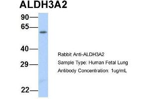 Host:  Rabbit  Target Name:  ALDH3A2  Sample Type:  Human Fetal Lung  Antibody Dilution:  1. (ALDH3A2 Antikörper  (Middle Region))