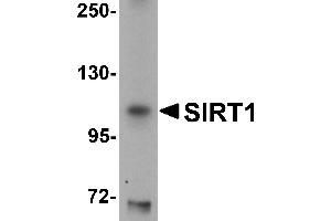Western Blotting (WB) image for anti-Sirtuin 1 (SIRT1) (N-Term) antibody (ABIN1031567) (SIRT1 Antikörper  (N-Term))