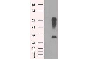 Western Blotting (WB) image for anti-Ring Finger Protein 144B (RNF144B) (AA 1-256) antibody (ABIN1490651) (RNF144B Antikörper  (AA 1-256))