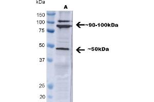 Western blot analysis of Human A549 showing detection of ~ 50 kDa TNF-R1 protein using Rabbit Anti-TNF-R1 Polyclonal Antibody (ABIN2482042). (TNFRSF1A Antikörper  (AA 20-43) (PE))