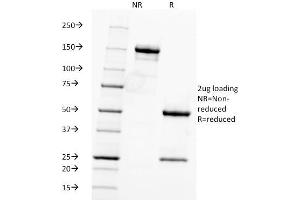 SDS-PAGE (SDS) image for anti-Fascin (FSCN1) antibody (ABIN6940606)