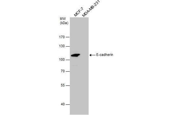 E-cadherin Antikörper