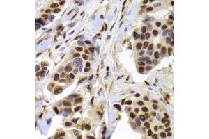 Immunohistochemistry (Paraffin-embedded Sections) (IHC (p)) image for anti-X-Ray Repair Complementing Defective Repair in Chinese Hamster Cells 5 (Double-Strand-Break Rejoining) (XRCC5) (AA 543-732) antibody (ABIN6150309)
