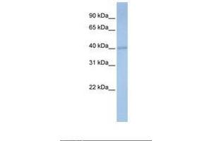 Image no. 1 for anti-Prenyl (Decaprenyl) Diphosphate Synthase, Subunit 1 (PDSS1) (AA 182-231) antibody (ABIN6738224) (PDSS1 Antikörper  (AA 182-231))