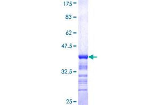 PCBP2 Protein (AA 174-283) (GST tag)