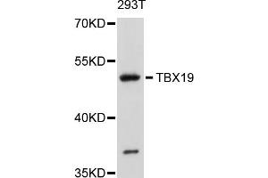 Western blot analysis of extracts of 293T cells, using TBX19 antibody (ABIN4905379) at 1:1000 dilution. (T-Box 19 Antikörper)