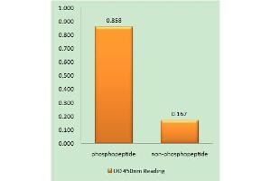 Immunohistochemistry analysis of paraffin-embedded human brain tissue using EPHA3/4/5 (Phospho-Tyr779/833) antibody. (EPH Receptor A3 Antikörper  (pTyr779, pTyr833))