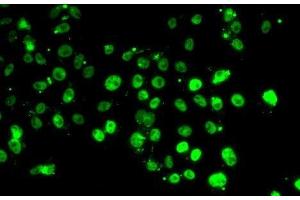 Immunofluorescence analysis of MCF7 cells using GABPB1 Polyclonal Antibody (GABPB1 Antikörper)