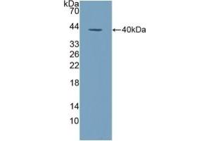 Detection of Recombinant ALPL, Human using Polyclonal Antibody to Alkaline Phosphatase, Tissue-nonspecific (ALPL) (ALPL Antikörper  (AA 18-335))