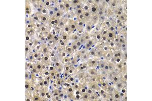 Immunohistochemistry of paraffin-embedded rat liver using KPNA4 Antibody (ABIN5971058) at dilution of 1/100 (40x lens). (KPNA4 Antikörper)