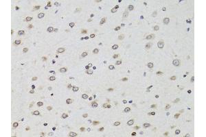 Immunohistochemistry of paraffin-embedded mouse brain using TMPO Antibody (ABIN1875122) at dilution of 1:100 (40x lens). (Thymopoietin Antikörper)