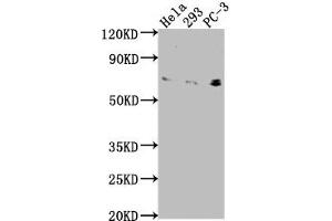 Western Blot Positive WB detected in: Hela whole cell lysate, 293 whole cell lysate, PC-3 whole cell lysate All lanes: EXOC7 antibody at 1:2000 Secondary Goat polyclonal to rabbit IgG at 1/50000 dilution Predicted band size: 84, 79, 75, 33, 78, 81 kDa Observed band size: 75 kDa (EXOC7 Antikörper  (AA 521-735))