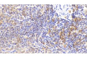 Detection of HLA-DRA in Rabbit Spleen Tissue using Polyclonal Antibody to HLA Class II Histocompatibility Antigen, DR Alpha Chain (HLA-DRA) (HLA-DRA Antikörper  (AA 26-221))