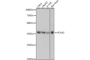 Western blot analysis of extracts of various cell lines, using  antibody (ABIN7265367) at 1:1000 dilution. (ACAA2 Antikörper)
