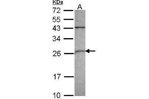 WB Image Sample (30 ug of whole cell lysate) A: 293T 12% SDS PAGE GST A4 antibody antibody diluted at 1:1000 (GSTA4 Antikörper)