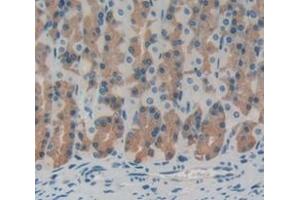 Immunohistochemistry (IHC) image for anti-Bone Morphogenetic Protein 4 (BMP4) (AA 209-392) antibody (ABIN1858154)