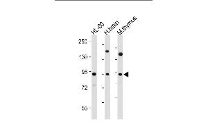 All lanes : Anti-ENASE Antibody (Center) at 1:2000 dilution Lane 1: HL-60 whole cell lysate Lane 2: human brain tissue lysate Lane 3: mouse thymus tissue lysate Lysates/proteins at 20 μg per lane. (ENGASE Antikörper  (AA 326-354))