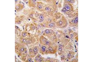 Image no. 1 for anti-Insulin-Degrading Enzyme (IDE) (Center) antibody (ABIN356957)