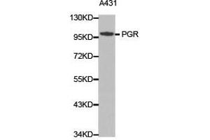 Western Blotting (WB) image for anti-Progesterone Receptor (PGR) antibody (ABIN1874114)