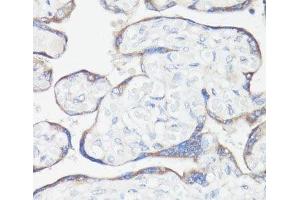 Immunohistochemistry of paraffin-embedded Human placenta using CLUH Polyclonal Antibody at dilution of 1:100 (40x lens). (CLUH Antikörper)