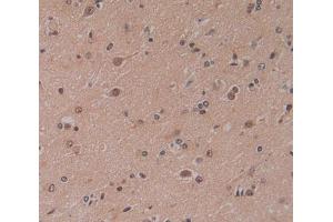 Used in DAB staining on fromalin fixed paraffin- embedded brain tissue (CBY1/PGEA1 Antikörper  (AA 12-115))
