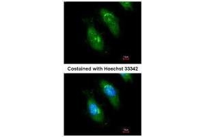 ICC/IF Image Immunofluorescence analysis of methanol-fixed HeLa, using SMN1, antibody at 1:200 dilution. (SMN1 Antikörper)