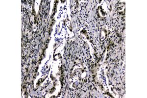 Immunohistochemistry (IHC) image for anti-SUMO1 Activating Enzyme Subunit 2 (UBA2) (AA 449-564) antibody (ABIN5692937)