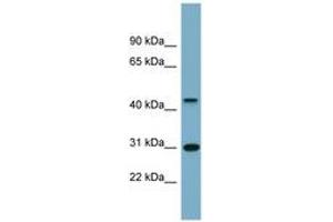 Image no. 1 for anti-Armadillo Repeat Containing, X-Linked 3 (ARMCX3) (AA 251-300) antibody (ABIN6743449) (ARMCX3 Antikörper  (AA 251-300))