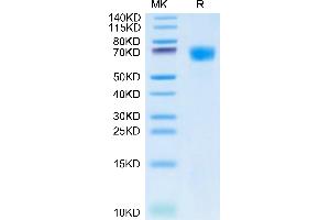 Hemopexin Protein (HPX) (AA 24-462) (His tag)