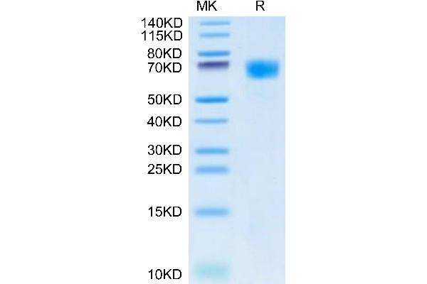 Hemopexin Protein (HPX) (AA 24-462) (His tag)